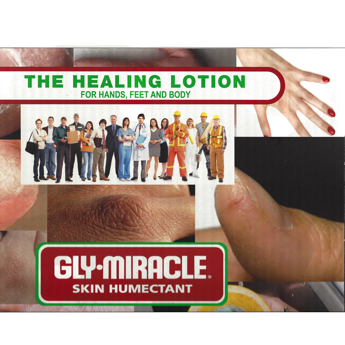 GLY MIRACLE Skin Humectant, the healing lotion for hands, feet and body, trusted by working professionals