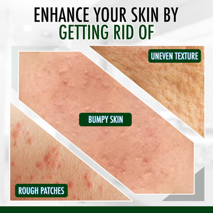 GLY MIRACLE Fragrance-Free Skin Lotion – 3-Pack Travel Tubes (0.5 oz Each) | Deep, Non-Greasy Hydration for Dry, Cracked, Irritated Skin