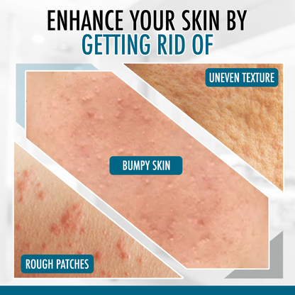 GLY MIRACLE Body Lotion for Extremely Dry Skin – 16 oz Pump Bottle | Fast-Absorbing, Non-Greasy Moisture for Hands, Body & Feet | Glycerin-Rich, Light, Fresh Scent