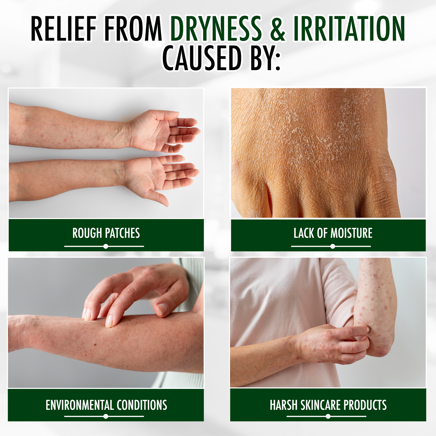 GLY MIRACLE Fragrance-Free Skin Lotion – 3-Pack Travel Tubes (0.5 oz Each) | Deep, Non-Greasy Hydration for Dry, Cracked, Irritated Skin