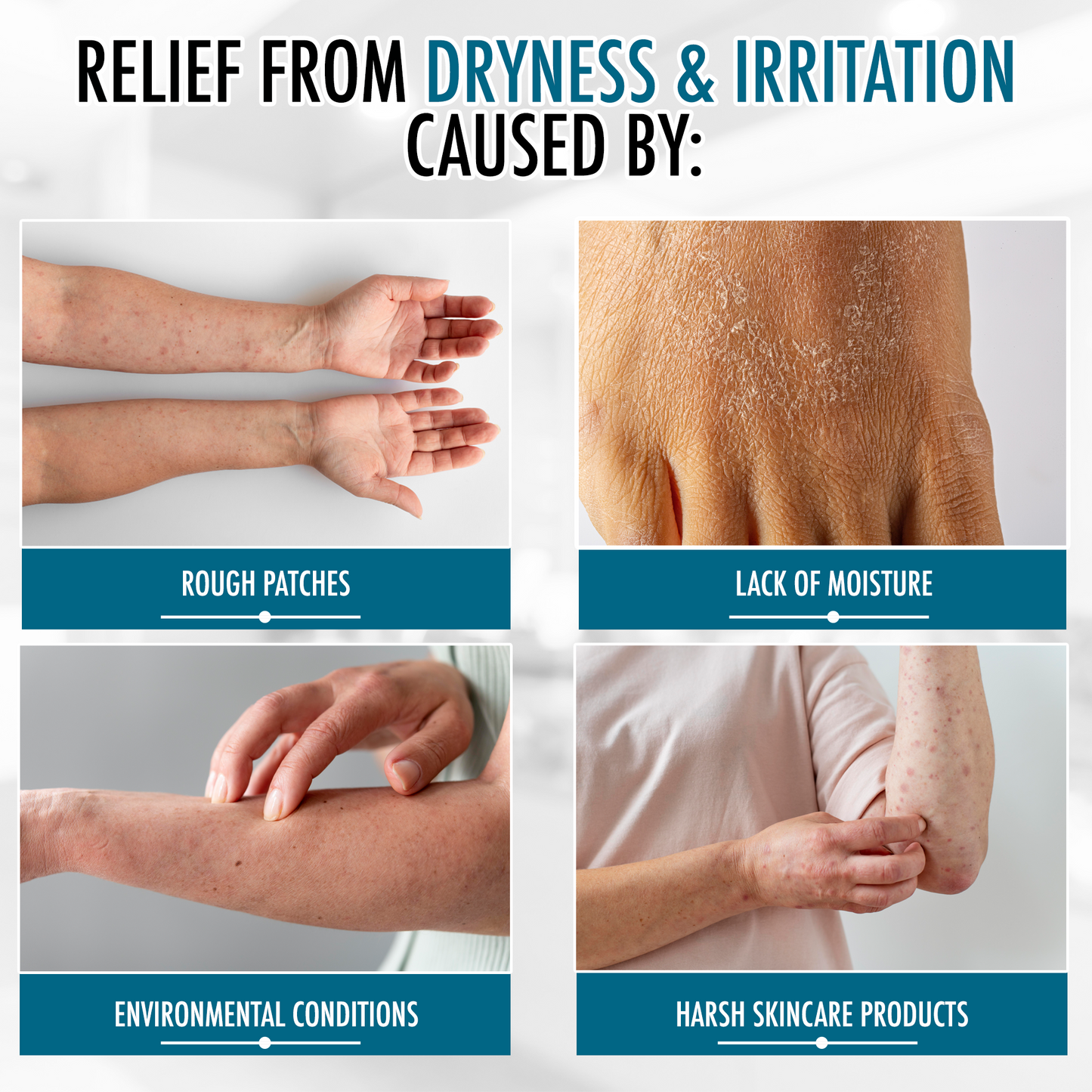 GLY MIRACLE Dry Skin Lotion – 2 oz tube | Light Fresh Scent | Deep, Non-Greasy Hydration for Dry, Cracked Hands, Cuticles & Feet