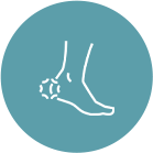 Cracked & Rough Heels